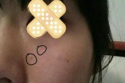 苹果手机拍照出现黑圈？如何解决这个问题？