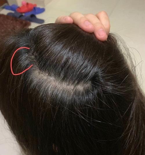 手机放在头顶拍照躺着会有什么效果？是否安全？