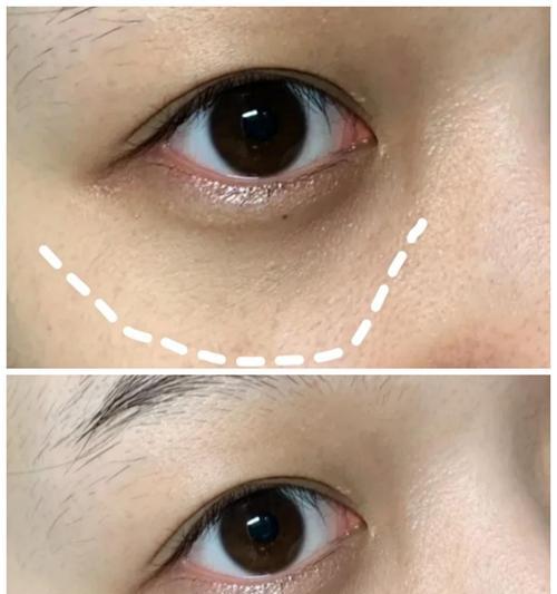 手机拍照太黑如何进行修复？