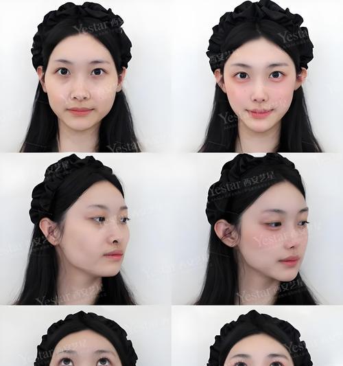 手机拍照如何实现自然瘦脸效果？