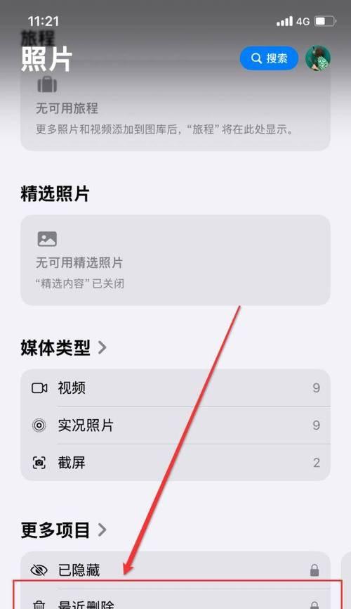 苹果手机镜头如何卸载？卸载过程中需要注意什么？